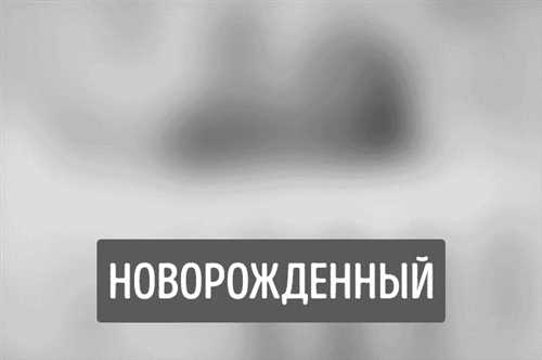 Осмотр